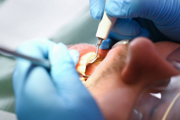 Best Emergency Dental Care for Broken or Chipped Teeth in Bren Bow, OK