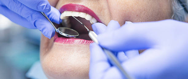 Best Emergency Root Canal Treatment in Bren Bow, OK