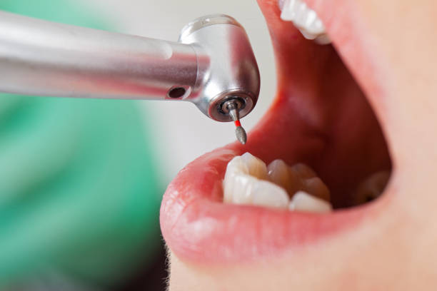 Best Emergency Dental Care for Broken or Chipped Teeth in Bren Bow, OK